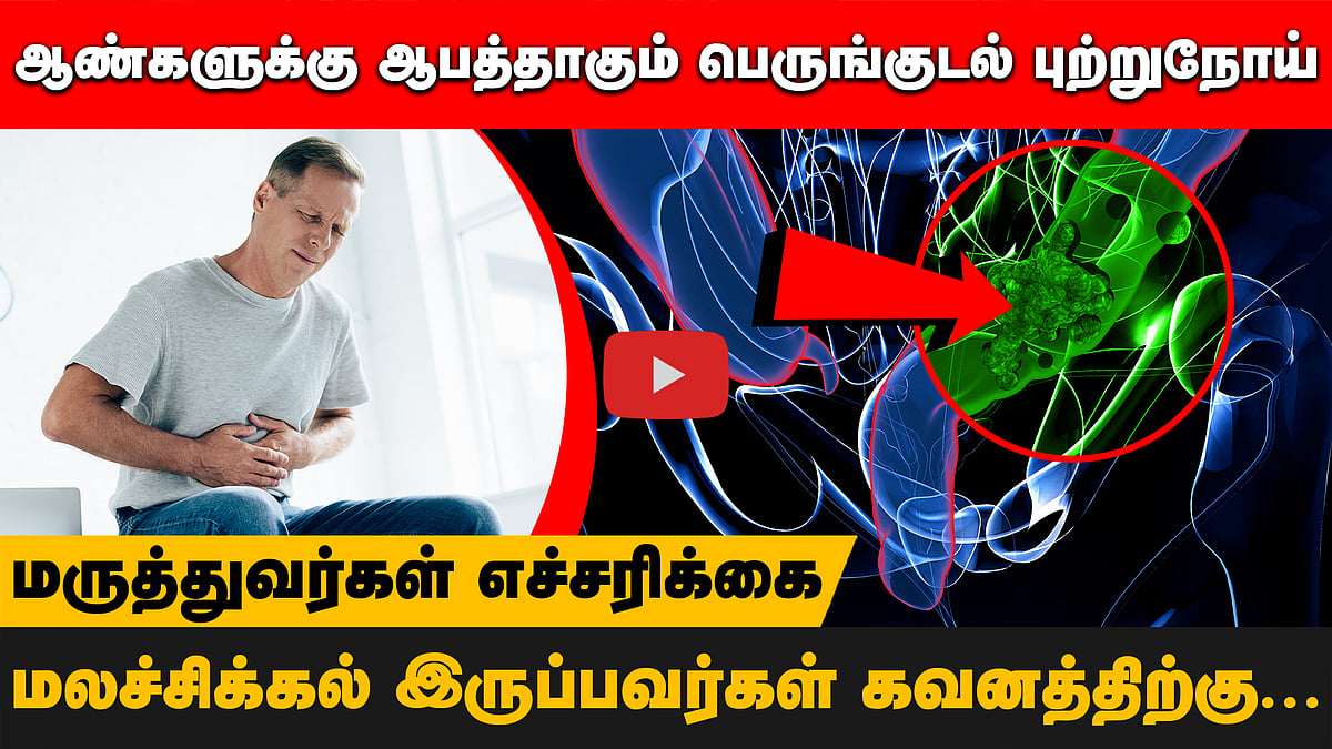 ஆண்களுக்கு ஆபத்தாகும் பெருங்குடல் புற்றுநோய்! எச்சரிக்கும் மருத்துவர்கள்! | Colon cancer |HealthTips