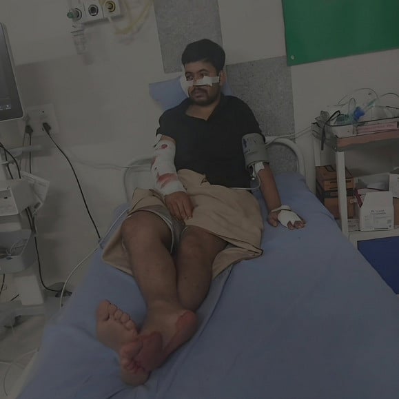 சிறுத்தை  தாக்கி இளைஞா்  படுகாயம்