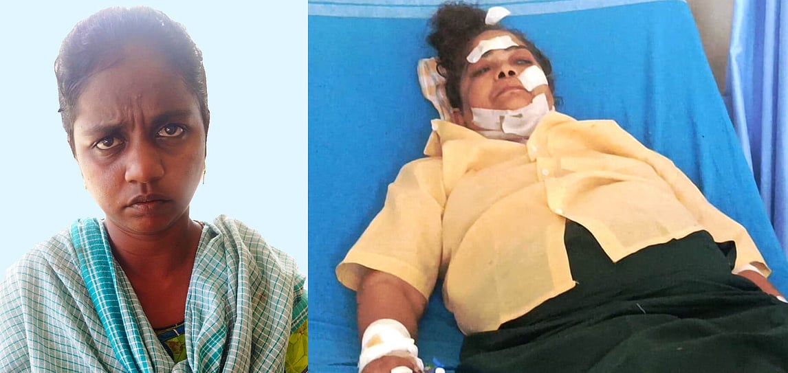 வீட்டுக்குள் கணக்கெடுப்பு நடத்த வந்தது போல் புகுந்து பெண்ணை கத்தியால் குத்தி நகை பறிக்க முயற்சி: இளம்பெண் கைது