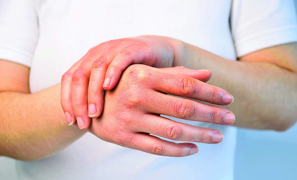 ஆயுள் காக்கும் ஆயுர்வேதம்: பனி... பசி... வறட்சி!