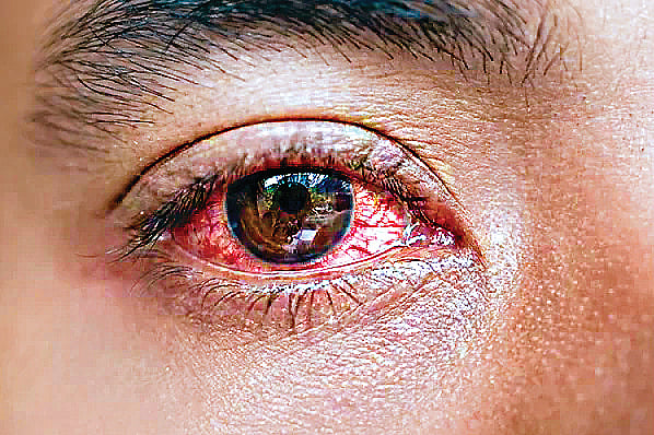 ஆயுள் காக்கும் ஆயுர்வேதம்: கண்நோய் நீங்க...