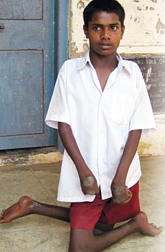 சிறப்பு ஆசிரியர் நியமிக்கப்படுவாரா?: தேர்வெழுத முடியாமல் அவதியுறும் 'மாற்றுத்திறன்' மாணவர்