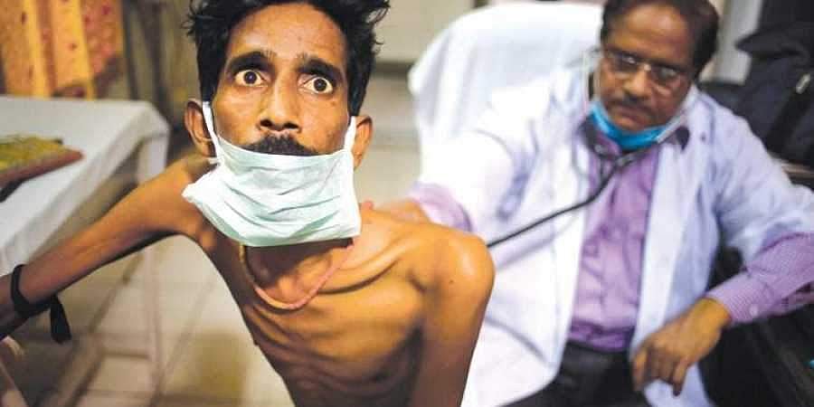 இன்று காசநோய் நாள்: காசநோயும் ஓர் இயற்கைப் பேரிடர்தான்