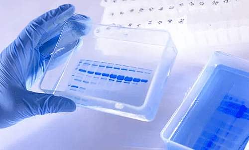 அதிகரித்து வரும் பாதிப்பு: தூத்துக்குடியில் கரோனா ஆய்வகம் அமைக்கப்படுமா?