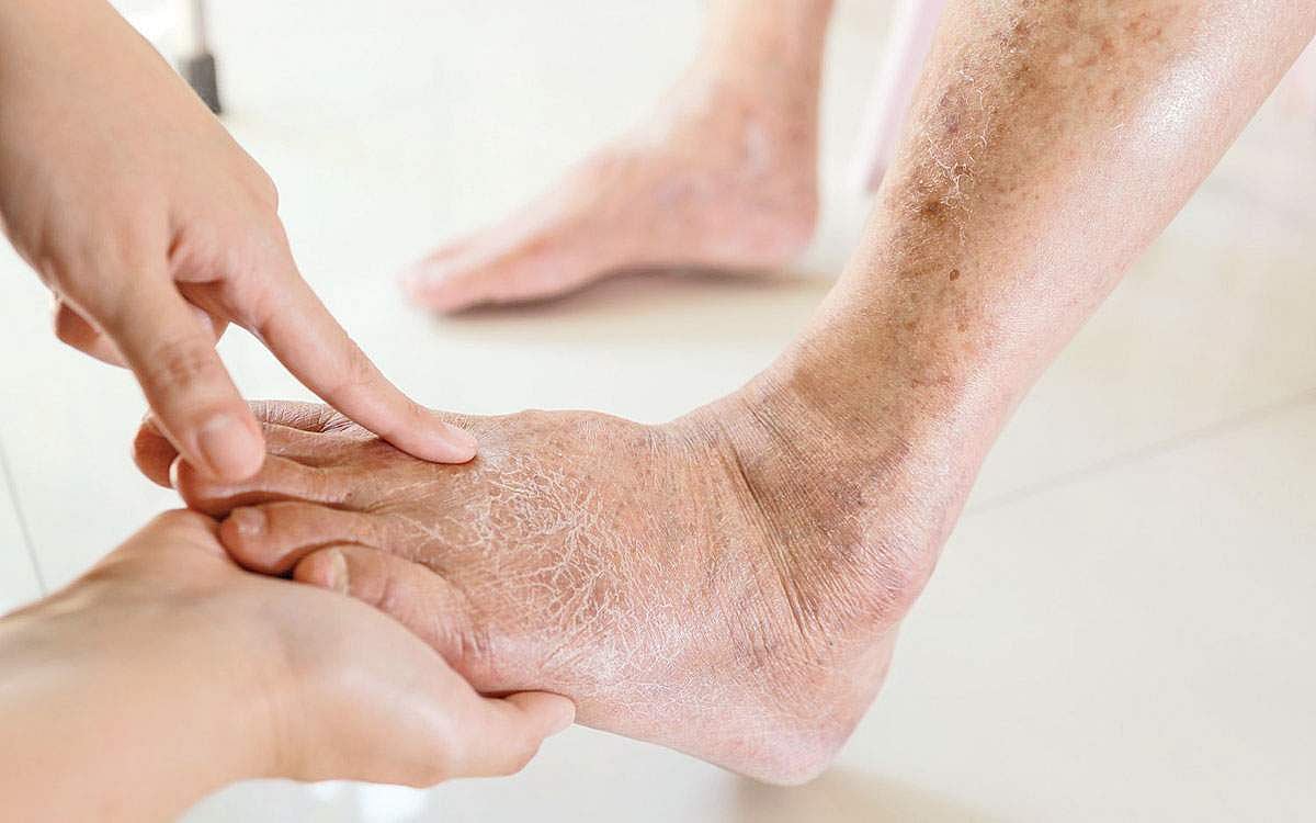 ஆயுள் காக்கும் ஆயுர்வேதம்: நீரிழிவு நோய் பாதிப்பு தப்பிக்க வழி?